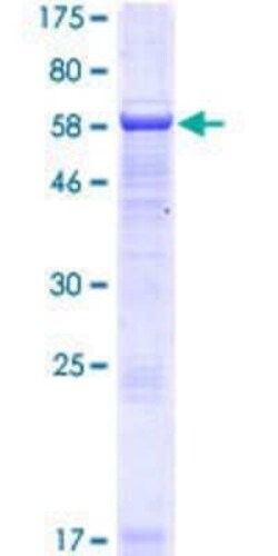 Novus Biologicals Recombinant Human SERTAD4 GST (N-Term) Protein 25 &mu;g | Buy Online | Novus Biologicals&trade; | Fisher Scientific