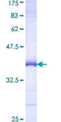 Novus Biologicals Recombinant Human CTNNBL1 GST (N-Term) Protein 10 &mu;g | Buy Online | Novus Biologicals&trade; | Fisher Scientific