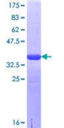 Novus Biologicals Recombinant Human LRRC8A GST (N-Term) Protein 10 &mu;g | Buy Online | Novus Biologicals&trade; | Fisher Scientific