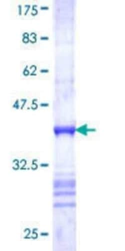 Novus Biologicals Recombinant Human TRPV5 GST (N-Term) Protein 10 &mu;g | Buy Online | Novus Biologicals&trade; | Fisher Scientific