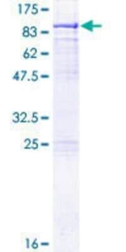 Novus Biologicals Recombinant Human Methyltransferase like 3 GST (N-Term) Protein 25 &mu;g | Buy Online | Novus Biologicals&trade; | Fisher Scientific