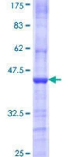 Novus Biologicals Recombinant Human PRMT8 GST (N-Term) Protein 25 &mu;g | Buy Online | Novus Biologicals&trade; | Fisher Scientific
