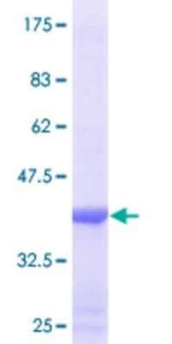 Novus Biologicals Recombinant Human Cytochrome P450 26B1 GST (N-Term) Protein 25 &mu;g | Buy Online | Novus Biologicals&trade; | Fisher Scientific