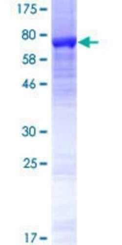 Novus Biologicals Recombinant Human TUBB4Q GST (N-Term) Protein 10 &mu;g | Buy Online | Novus Biologicals&trade; | Fisher Scientific