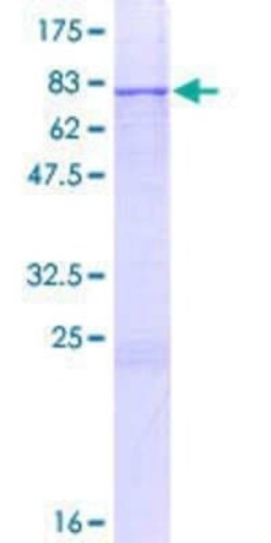 Novus Biologicals Recombinant Human ERO1LB GST (N-Term) Protein 10 &mu;g | Buy Online | Novus Biologicals&trade; | Fisher Scientific