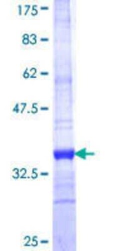 Novus Biologicals Recombinant Human GLUT9 GST (N-Term) Protein 25 &mu;g | Buy Online | Novus Biologicals&trade; | Fisher Scientific