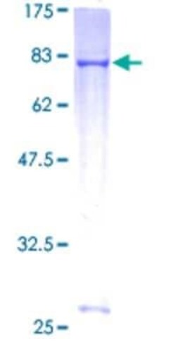 Novus Biologicals Recombinant Human RNF23 GST (N-Term) Protein 10 &mu;g | Buy Online | Novus Biologicals&trade; | Fisher Scientific