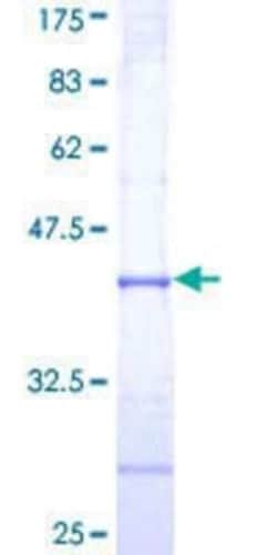 Novus Biologicals Recombinant Human RNF23 GST (N-Term) Protein 10 &mu;g | Buy Online | Novus Biologicals&trade; | Fisher Scientific