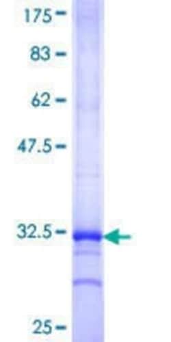 Novus Biologicals Recombinant Human KCNK12 GST (N-Term) Protein 10 &mu;g | Buy Online | Novus Biologicals&trade; | Fisher Scientific