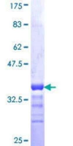 Novus Biologicals Recombinant Human JPH1 GST (N-Term) Protein 25 &mu;g | Buy Online | Novus Biologicals&trade; | Fisher Scientific