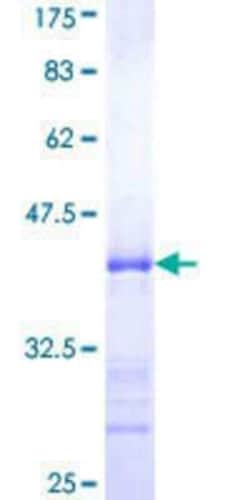Novus Biologicals Recombinant Human SLC2A4RG GST (N-Term) Protein 25 &mu;g | Buy Online | Novus Biologicals&trade; | Fisher Scientific