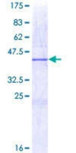 Novus Biologicals Recombinant Human FMN2 GST (N-Term) Protein 10 &mu;g | Buy Online | Novus Biologicals&trade; | Fisher Scientific