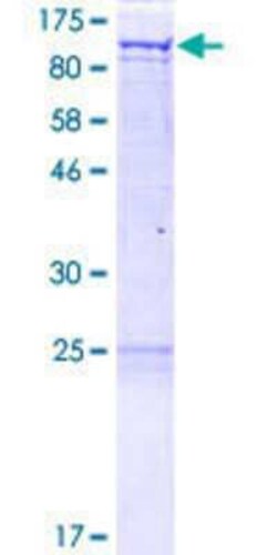 Novus Biologicals Recombinant Human GRASP1 GST (N-Term) Protein 2 &mu;g | Buy Online | Novus Biologicals&trade; | Fisher Scientific