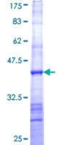 Novus Biologicals Recombinant Human TC-1 GST (N-Term) Protein 25 &mu;g | Buy Online | Novus Biologicals&trade; | Fisher Scientific