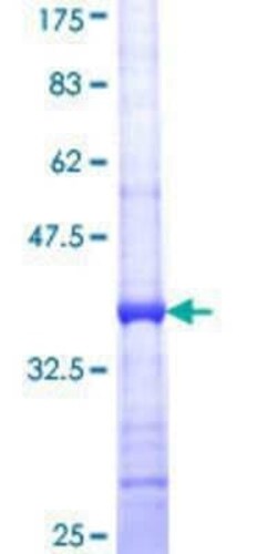 Novus Biologicals Recombinant Human AGPAT3 GST (N-Term) Protein 10 &mu;g | Buy Online | Novus Biologicals&trade; | Fisher Scientific