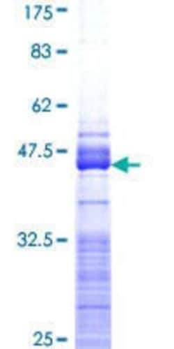 Novus Biologicals Recombinant Human CRMP5 GST (N-Term) Protein 10 &mu;g | Buy Online | Novus Biologicals&trade; | Fisher Scientific