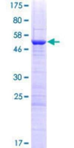 Novus Biologicals Recombinant Human PNO1 GST (N-Term) Protein 10 &mu;g | Buy Online | Novus Biologicals&trade; | Fisher Scientific