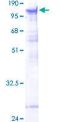 Novus Biologicals Recombinant Human PAPOLB GST (N-Term) Protein 25 &mu;g | Buy Online | Novus Biologicals&trade; | Fisher Scientific