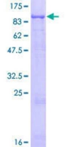 Novus Biologicals Recombinant Human MCCC1 GST (N-Term) Protein 10 &mu;g | Buy Online | Novus Biologicals&trade; | Fisher Scientific