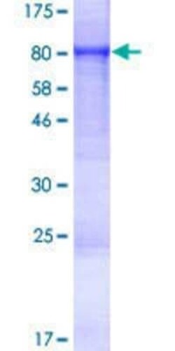 Novus Biologicals Recombinant Human FEM1C GST (N-Term) Protein 25 &mu;g | Buy Online | Novus Biologicals&trade; | Fisher Scientific