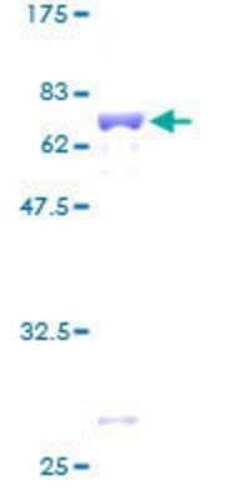 Novus Biologicals Recombinant Human MRPS22 GST (N-Term) Protein 25 &mu;g | Buy Online | Novus Biologicals&trade; | Fisher Scientific