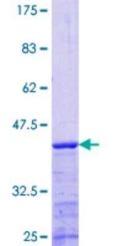 Novus Biologicals Recombinant Human MRPS22 GST (N-Term) Protein 25 &mu;g | Buy Online | Novus Biologicals&trade; | Fisher Scientific