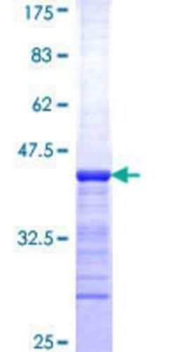 Novus Biologicals Recombinant Human EMSY GST (N-Term) Protein 10 &mu;g | Buy Online | Novus Biologicals&trade; | Fisher Scientific