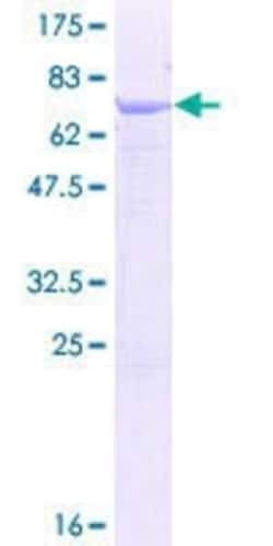 Novus Biologicals Recombinant Human SMYD2 GST (N-Term) Protein 25 &mu;g | Buy Online | Novus Biologicals&trade; | Fisher Scientific