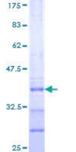 Novus Biologicals Recombinant Human LHX9 GST (N-Term) Protein 25 &mu;g | Buy Online | Novus Biologicals&trade; | Fisher Scientific