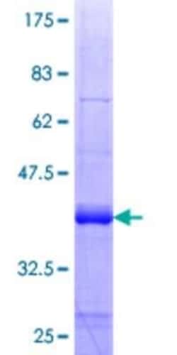 Novus Biologicals Recombinant Human LHX9 GST (N-Term) Protein 25 &mu;g | Buy Online | Novus Biologicals&trade; | Fisher Scientific