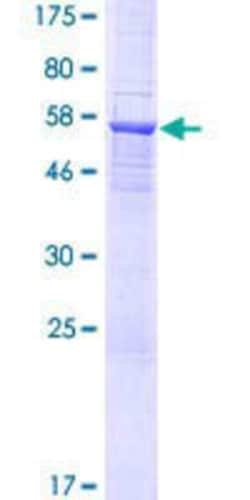 Novus Biologicals Recombinant Human DTWD1 GST (N-Term) Protein 25 &mu;g | Buy Online | Novus Biologicals&trade; | Fisher Scientific
