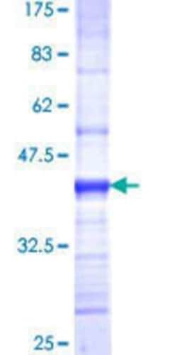 Novus Biologicals Recombinant Human TOMM22 GST (N-Term) Protein 25 &mu;g | Buy Online | Novus Biologicals&trade; | Fisher Scientific
