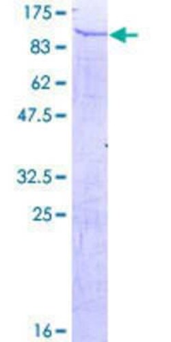 Novus Biologicals Recombinant Human TULP4 GST (N-Term) Protein 25 &mu;g | Buy Online | Novus Biologicals&trade; | Fisher Scientific