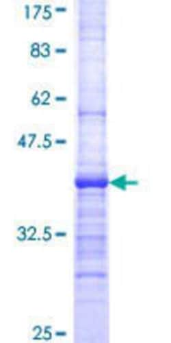 Novus Biologicals Recombinant Human CABC1 GST (N-Term) Protein 25 &mu;g | Buy Online | Novus Biologicals&trade; | Fisher Scientific