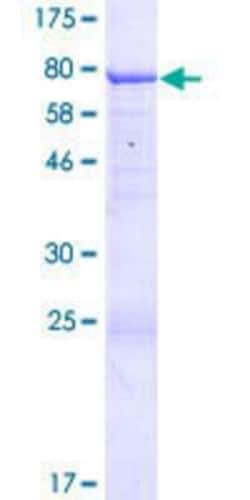 Novus Biologicals Recombinant Human ANKMY2 GST (N-Term) Protein 10 &mu;g | Buy Online | Novus Biologicals&trade; | Fisher Scientific