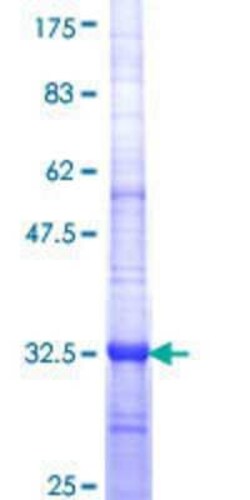 Novus Biologicals Recombinant Human DAZ3 GST (N-Term) Protein 25 &mu;g | Buy Online | Novus Biologicals&trade; | Fisher Scientific