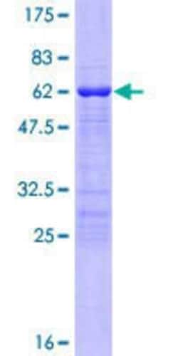 Novus Biologicals Recombinant Human TBX20 GST (N-Term) Protein 10 &mu;g | Buy Online | Novus Biologicals&trade; | Fisher Scientific