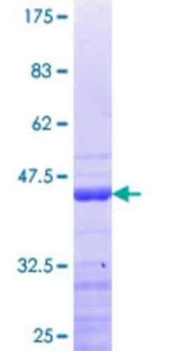 Novus Biologicals Recombinant Human DDX24 GST (N-Term) Protein 10 &mu;g | Buy Online | Novus Biologicals&trade; | Fisher Scientific