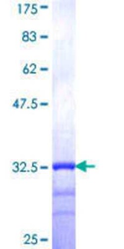 Novus Biologicals Recombinant Human AGTRAP GST (N-Term) Protein 25 &mu;g | Buy Online | Novus Biologicals&trade; | Fisher Scientific