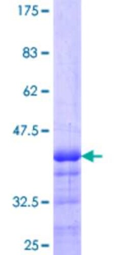 Novus Biologicals Recombinant Human AVEN GST (N-Term) Protein 25 &mu;g | Buy Online | Novus Biologicals&trade; | Fisher Scientific