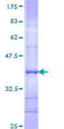 Novus Biologicals Recombinant Human REXO4 GST (N-Term) Protein 10 &mu;g | Buy Online | Novus Biologicals&trade; | Fisher Scientific
