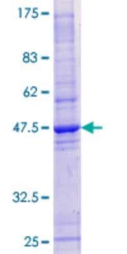 Novus Biologicals Recombinant Human HRAS like suppressor GST (N-Term) Protein 10 &mu;g | Buy Online | Novus Biologicals&trade; | Fisher Scientific
