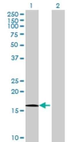 Novus Biologicals&trade;&nbsp;HRAS like suppressor 293T Cell Transient Overexpression Lysate