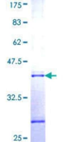 Novus Biologicals Recombinant Human Rab25 GST (N-Term) Protein 25 &mu;g | Buy Online | Novus Biologicals&trade; | Fisher Scientific