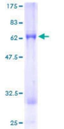 Novus Biologicals Recombinant Human CAMKID GST (N-Term) Protein 25 &mu;g | Buy Online | Novus Biologicals&trade; | Fisher Scientific