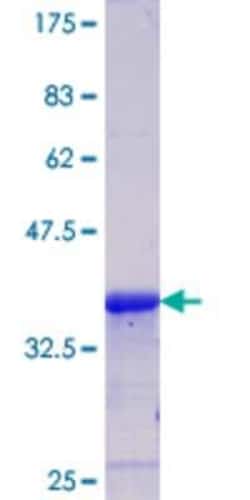 Novus Biologicals Recombinant Human CAMKID GST (N-Term) Protein 10 &mu;g | Buy Online | Novus Biologicals&trade; | Fisher Scientific