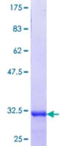 Novus Biologicals Recombinant Human LPAR5/LPA5/GPR92 GST (N-Term) Protein 25 &mu;g | Buy Online | Novus Biologicals&trade; | Fisher Scientific