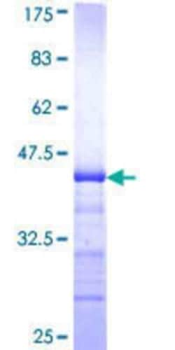 Novus Biologicals Recombinant Human TEM7/PLXDC1 GST (N-Term) Protein 10 &mu;g | Buy Online | Novus Biologicals&trade; | Fisher Scientific