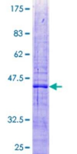 Novus Biologicals Recombinant Human MRPL47 GST (N-Term) Protein 2 &mu;g | Buy Online | Novus Biologicals&trade; | Fisher Scientific