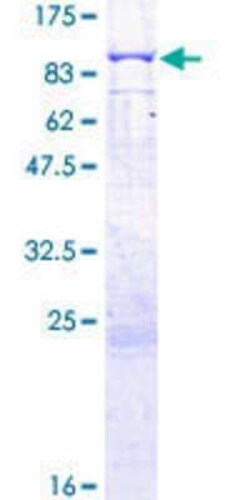 Novus Biologicals Recombinant Human MAN1C1 GST (N-Term) Protein 2 &mu;g | Buy Online | Novus Biologicals&trade; | Fisher Scientific